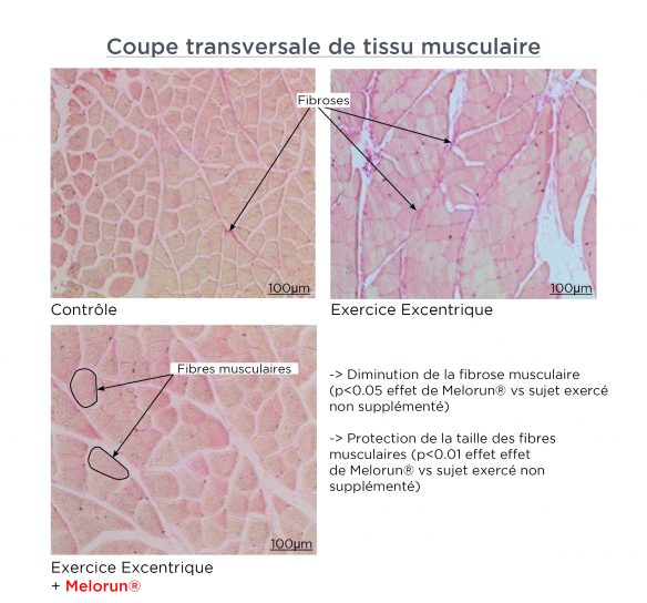 Muscle tissue cross-section_FR